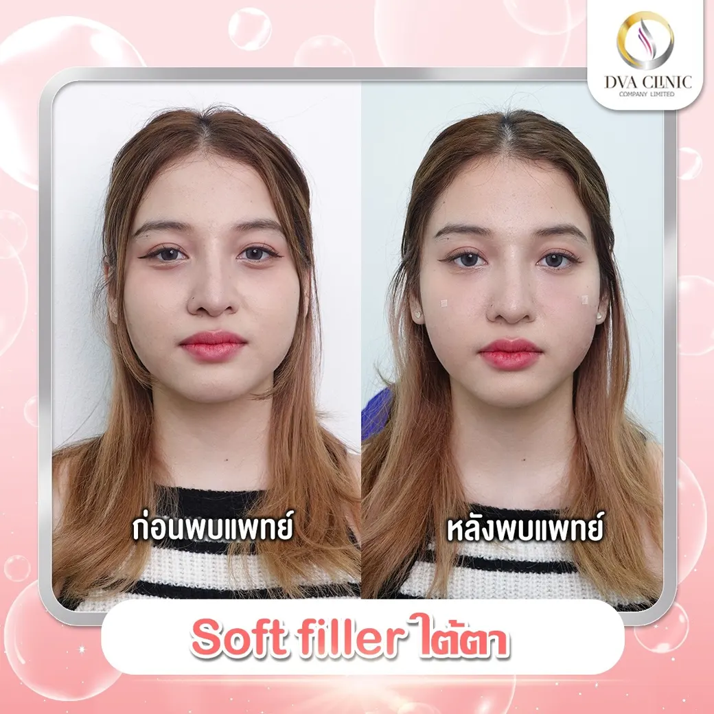 รีวิวจากลูกค้า DVA Clinic