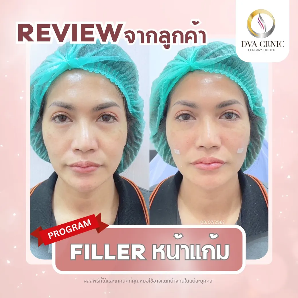 รีวิวจากลูกค้า DVA Clinic